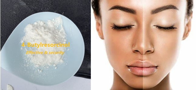 4-butylresorcinol whitening agent