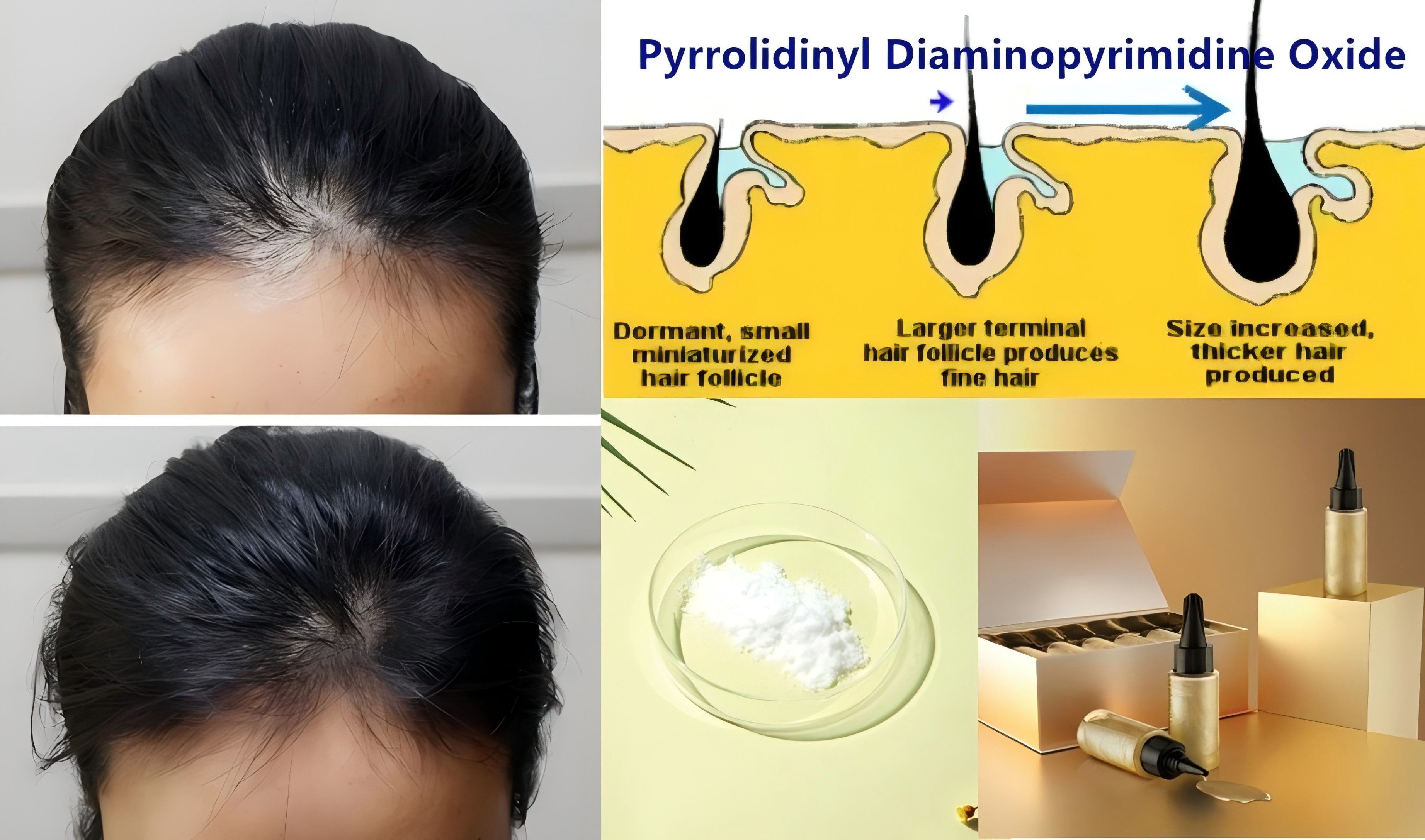 Pyrrolidinyl diaminopyrimide oxide-1.jpg